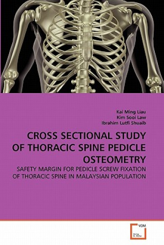 Livre Cross Sectional Study of Thoracic Spine Pedicle Osteometry Kai Ming Liau