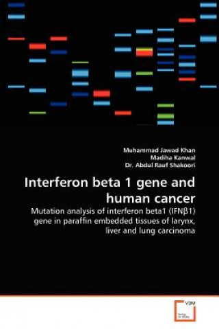 Carte Interferon beta 1 gene and human cancer Muhammad Jawad Khan
