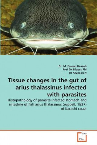 Carte Tissue changes in the gut of arius thalassinus infected with parasites Farooq Haseeb