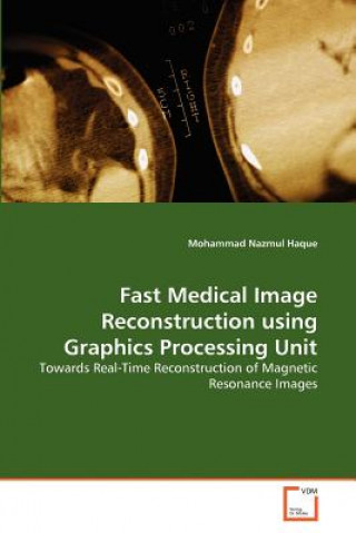 Kniha Fast Medical Image Reconstruction using Graphics Processing Unit Mohammad Nazmul Haque