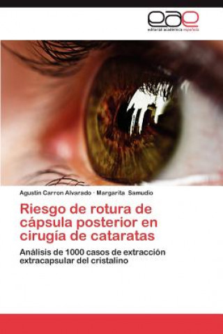 Książka Riesgo de Rotura de Capsula Posterior En Cirugia de Cataratas Agustin Carron Alvarado