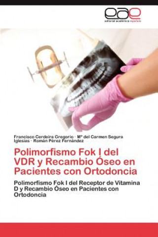Kniha Polimorfismo Fok I del VDR y Recambio Oseo en Pacientes con Ortodoncia Francisco Cerdeira Gregorio