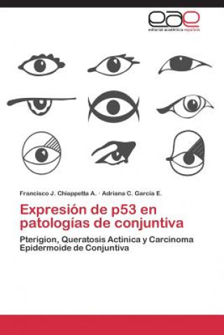 Könyv Expresion de P53 En Patologias de Conjuntiva Francisco J. Chiappetta A.