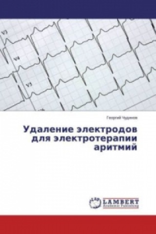 Carte Udalenie elektrodov dlya elektroterapii aritmiy Georgiy Chudinov