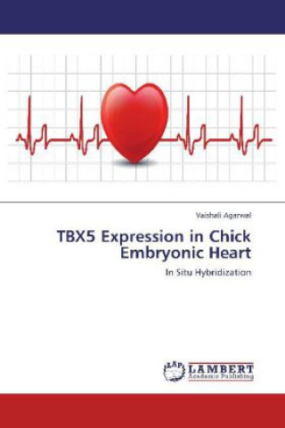 Carte TBX5 Expression in Chick Embryonic Heart Vaishali Agarwal