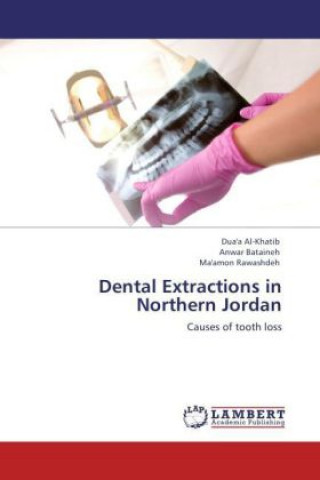 Könyv Dental Extractions in Northern Jordan Dua'a Al-Khatib