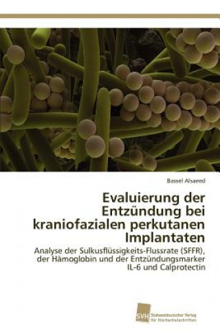 Book Evaluierung der Entzundung bei kraniofazialen perkutanen Implantaten Bassel Alsaeed