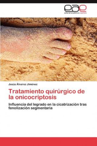 Kniha Tratamiento quirurgico de la onicocriptosis Jesús Álvarez Jiménez