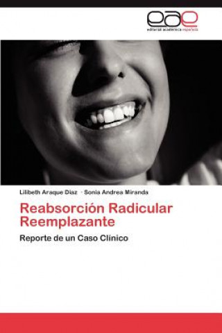Carte Reabsorcion Radicular Reemplazante Lilibeth Araque Diaz