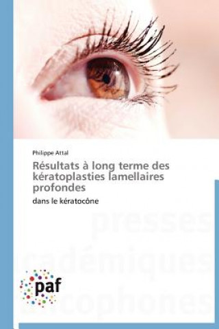 Könyv Resultats A Long Terme Des Keratoplasties Lamellaires Profondes Philippe Attal