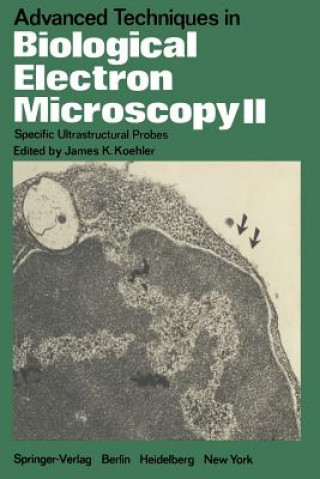 Kniha Advanced Techniques in Biological Electron Microscopy II J. K. Koehler