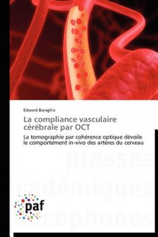 Carte Compliance Vasculaire Cerebrale Par Oct Edward Baraghis