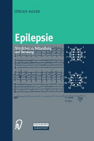 Kniha Epilepsie Jürgen Bauer