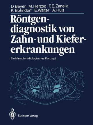 Książka Rontgendiagnostik von Zahn- und Kiefererkrankungen Dieter Beyer