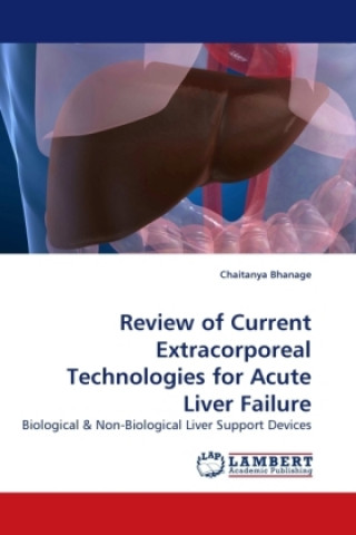 Kniha Review of Current Extracorporeal Technologies for Acute Liver Failure Chaitanya Bhanage