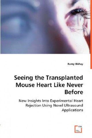 Książka Seeing the Transplanted Mouse Heart Like Never Before Ramy Bishay