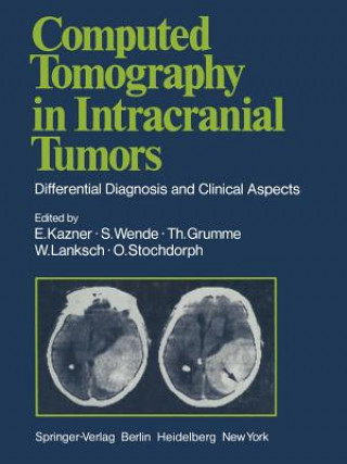 Könyv Computed Tomography in Intracranial Tumors G. B. Bradac