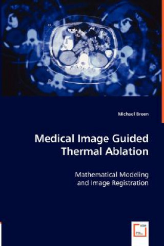 Libro Medical Image Guided Thermal Ablation Michael Breen