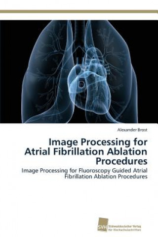 Carte Image Processing for Atrial Fibrillation Ablation Procedures Alexander Brost