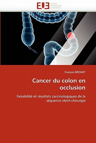 Könyv Cancer Du Colon En Occlusion François Browet