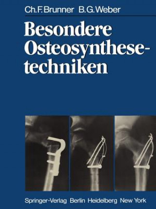 Książka Besondere Osteosynthesetechniken C. F. Brunner