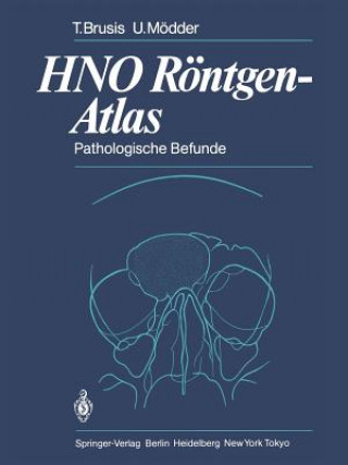 Kniha HNO Röntgen-Atlas Tilman Brusis