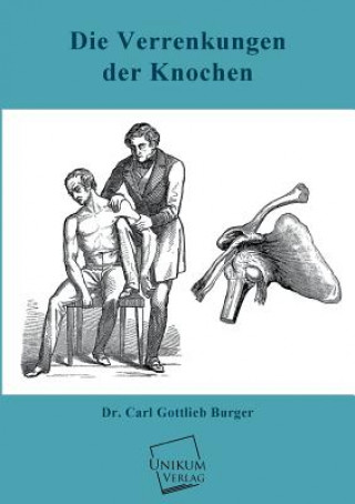 Kniha Verrenkungen Der Knochen Carl G. Burger