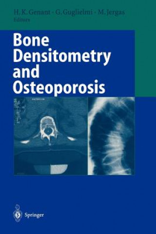 Kniha Bone Densitometry and Osteoporosis Harry K. Genant