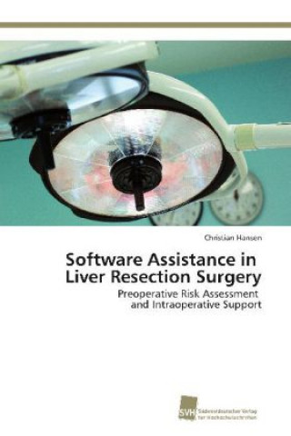 Knjiga Software Assistance in Liver Resection Surgery Christian Hansen