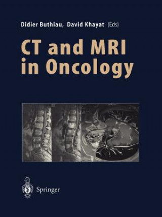 Knjiga CT and MRI in Oncology Didier Buthiau