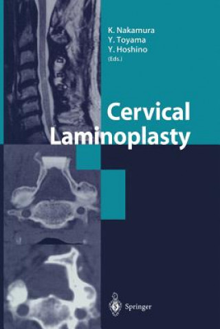 Libro Cervical Laminoplasty Y. Hoshino