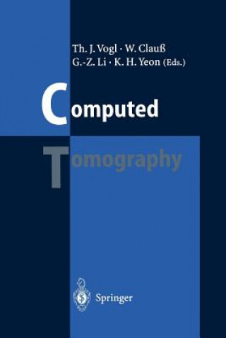 Książka Computed Tomography Wolfram Clauß