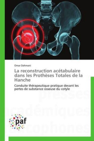 Carte La reconstruction acétabulaire dans les Prothèses Totales de la Hanche Omar Dahmani