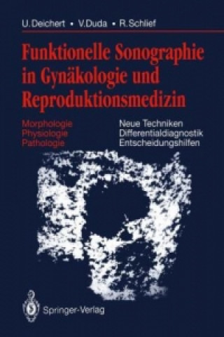 Książka Funktionelle Sonographie in Gynakologie und Reproduktionsmedizin Ulrich Deichert