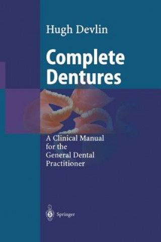 Knjiga Complete Dentures Hugh Devlin