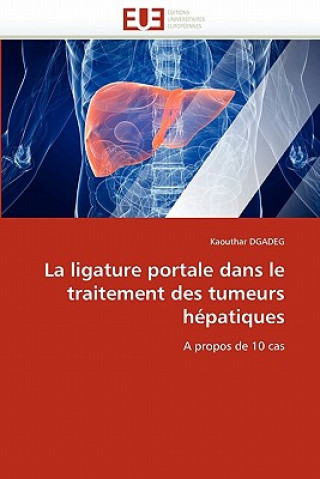 Книга La Ligature Portale Dans Le Traitement Des Tumeurs H patiques Kaouthar Dgadeg