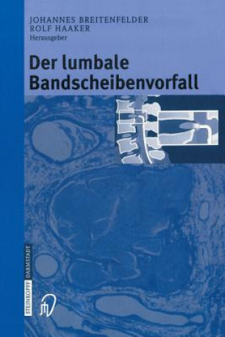 Książka Der lumbale Bandscheibenvorfall J. Breitenfelder