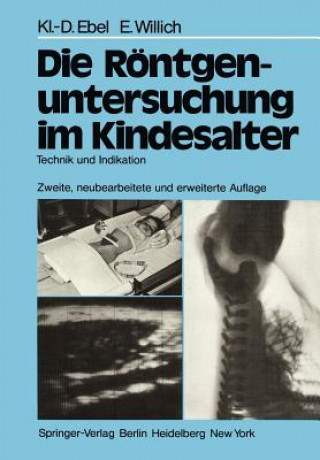 Kniha Die Rontgenuntersuchung im Kindesalter Klaus-D. Ebel