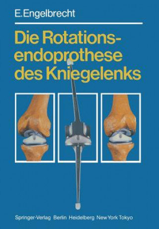 Книга Die Rotationsendoprothese des Kniegelenks E. Engelbrecht