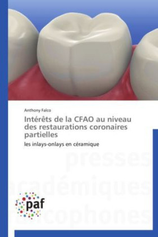 Livre Intér?ts de la CFAO au niveau des restaurations coronaires partielles Anthony Falco