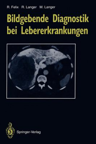 Kniha Bildgebende Diagnostik bei Lebererkrankungen Roland Felix