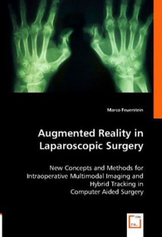 Kniha Augmented Reality in Laparoscopic Surgery Marco Feuerstein