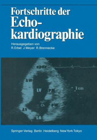 Kniha Fortschritte der Echokardiographie Rüdiger Brennecke