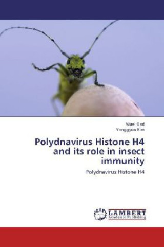 Carte Polydnavirus Histone H4 and its role in insect immunity Wael Gad