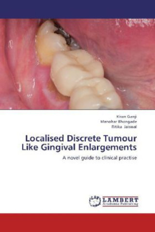 Книга Localised Discrete Tumour Like Gingival Enlargements Kiran Ganji