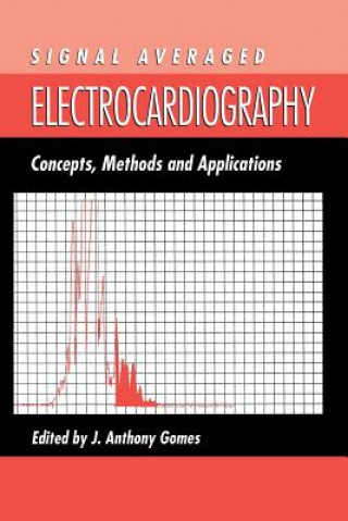 Carte Signal Averaged Electrocardiography J. A. Gomes