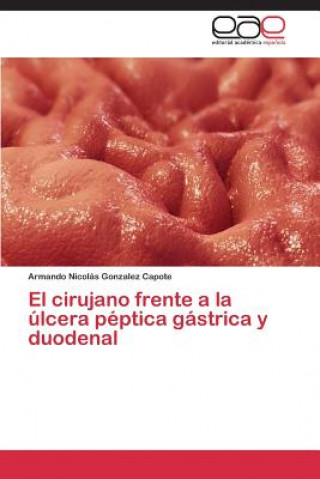 Könyv cirujano frente a la ulcera peptica gastrica y duodenal Armando Nicolás Gonzalez Capote