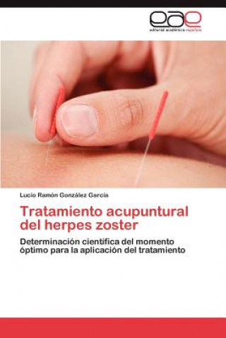 Książka Tratamiento Acupuntural del Herpes Zoster Lucio Ramón González García