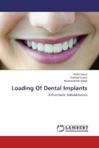 Carte Loading Of Dental Implants Nidhi Goyal