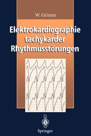 Carte Elektrokardiographie Tachykarder Rhythmusstorungen W. Grimm